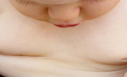 Übergewicht bei Kindern erkennen und bekämpfen